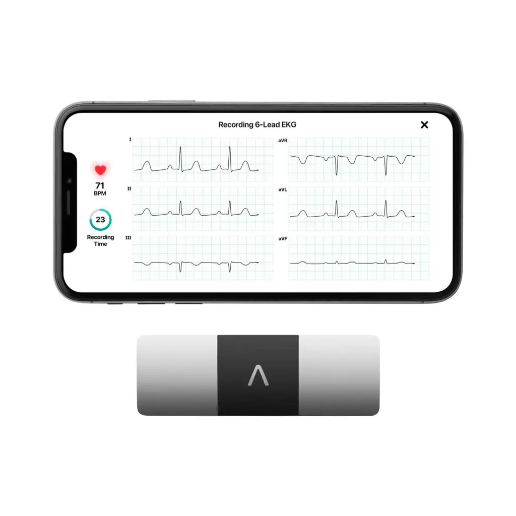 Kardie mobile heart monitor